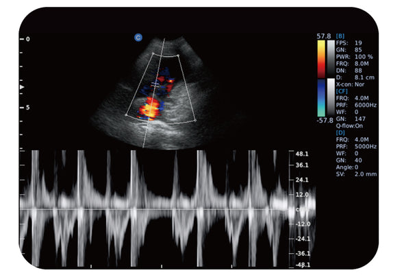 Chison ECO6Vet Color Doppler Ultrasound | Canine Cardiac PW Mode | KeeboVet