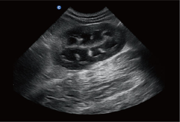 Ebit60 Vet Ultrasound Image Canine Kidney, B Mode