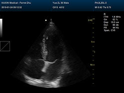 DCU30Vet Ultrasound  Images