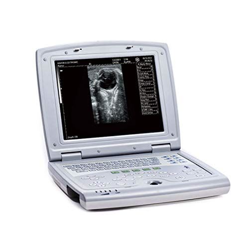 KX5000V Veterinary Laptop Ultrasound-Large Animal-Bovine/Horse- Keebomed