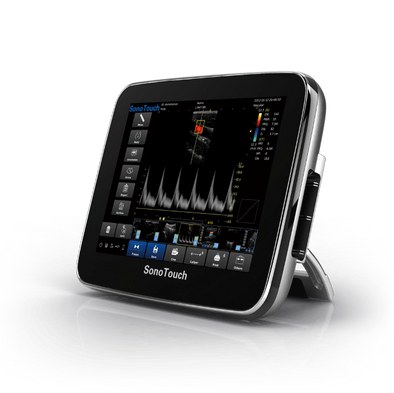 Chison Sonotouch 30Vet,Color doppler,Chison,KeeboVet Veterinary Ultrasound Equipment.