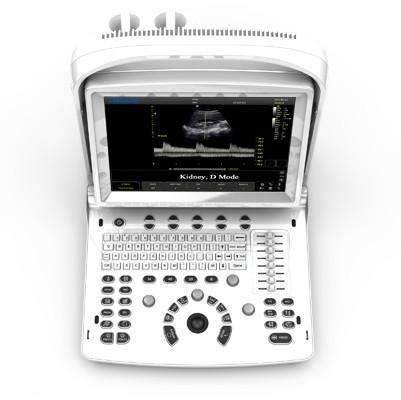 Chison ECO3 Vet Expert,Handheld ultrasounds,Chison,KeeboVet Veterinary Ultrasound Equipment.