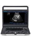 SonoScape A6V Expert - E1V Upgraded Veterinary Ultrasound | KeeboVet