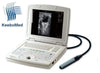 KX5000V Laptop Ultrasound Machine With Rectal Probe