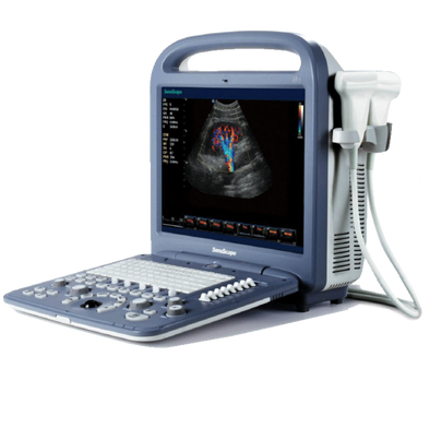 SonoScape S2V Ultrasound - Deals on Veterinary Ultrasounds
 - 1