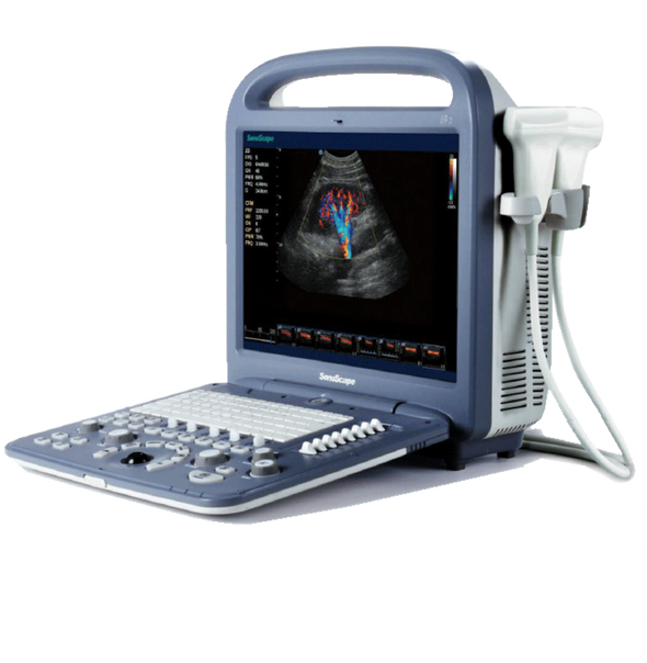 SonoScape S2V Ultrasound - Deals on Veterinary Ultrasounds
 - 1