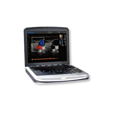 Chison SonoBook 6Vet Powerful Compact Color Doppler Ultrasound | KeeboVet