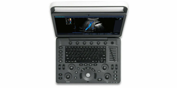Demo SonoScape E2 Ultrasound with One Linear Array Probe