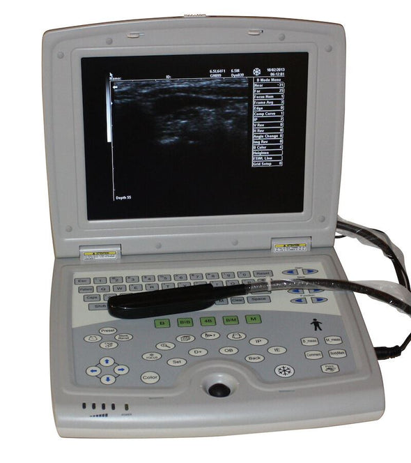 Veterinary Laptop - Animal Ultrasound Scanner - Bovine, Equine KeeboMed KX5000KV