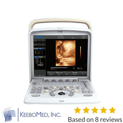Color Doppler Ultrasound Chison Q5, with 4D Probe for Obstetrics and Gynecology