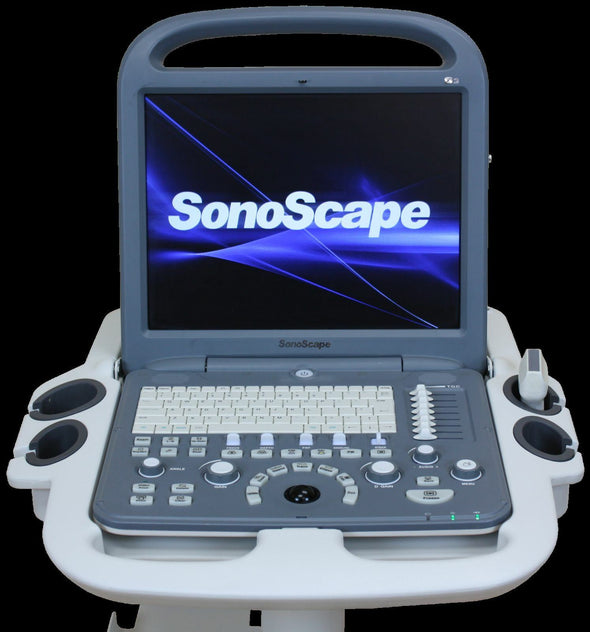 SonoScape S2 with Convex Abdominal Probe Included -  Excellent Condition