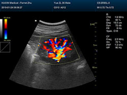 Newest- Color Portable Ultrasound & One Probe, DICOM, LED screen