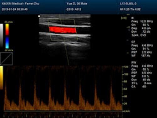 Newest- Color Portable Ultrasound & One Probe, DICOM, LED screen