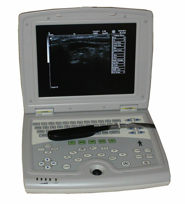 Refurbished KX5000V Vet Laptop Bovine Equine Ultrasound & Rectal Probe & Arm
