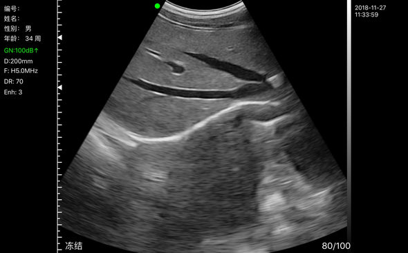 Wireless IOS Fetal Doppler Convex Probe Veterinary Ultrasound