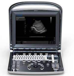 Chison ECO1 Vet Portable Black & White Ultrasound With Clear Images