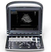 Chison ECO 1Vet,Portable Ultrasounds,Chison,KeeboVet Veterinary Ultrasound Equipment.