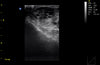 ECO1Vet Veterinary Ultrasound | Bovine Ovary