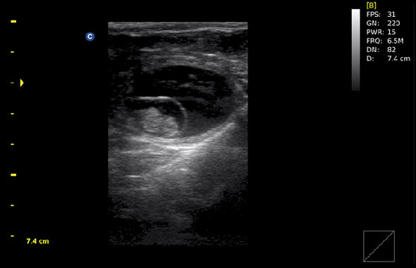 ECO1Vet Veterinary Ultrasound | Bovine Pregnacy
