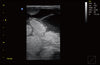 ECO1Vet Veterinary Ultrasound | Late Bovine Pregnancy