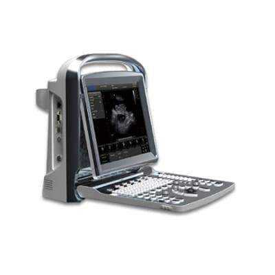 Chison ECO1 Vet Portable Ultrasound For Veterinary On Sale