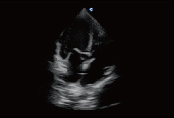 Ebit60 Vet Ultrasound Image Canine Cardiac, B Mode