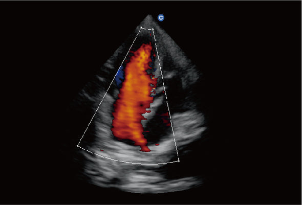 Ebit60 Vet Ultrasound Image Canine Cardiac, C Mode