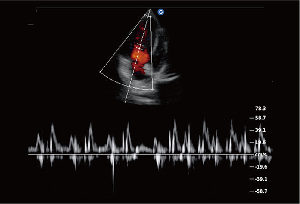 Ebit60 Vet Ultrasound Image Canine Cardiac, PW Mode