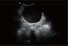 Ebit60 Vet Ultrasound Image Canine Cyst, C Mode