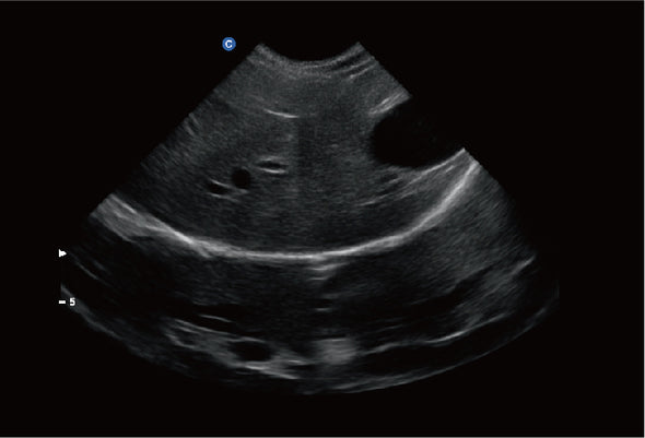 Ebit60 Vet Ultrasound Image Canine Liver, B Mode