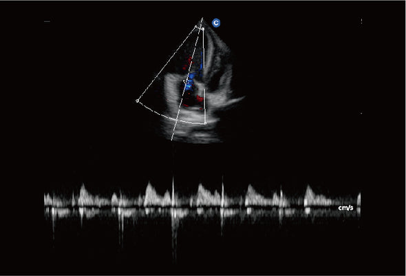 Ebit60 Vet Ultrasound Image Canine MV Regurgitation, PW Mode