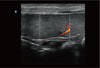 Ebit60 Vet Ultrasound Image Canine Spleen, C Mode