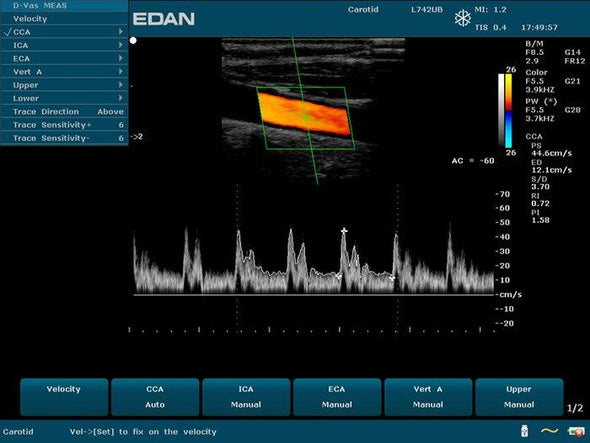 EDAN U50 Veterinary Ultrasound Model Sample Image