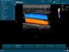 EDAN U50 Veterinary Ultrasound Model Sample Image