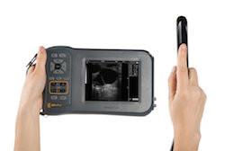 BovyEquiScan 60L Veterinary Ultrasound with Clear Images