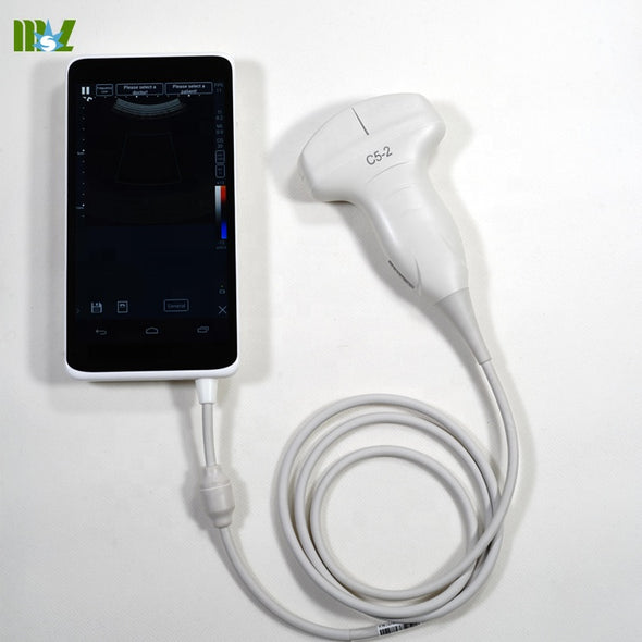 Convex Probe with Android Smart Phone
