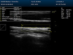 DCU30Vet Diagnostic Ultrasound  Images