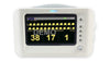KeeboVet Veterinary Ultrasound Equipment KM-13C Portable EtCO2 Monitor