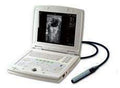 KX5000V Laptop Ultrasound Machine With Rectal Probe