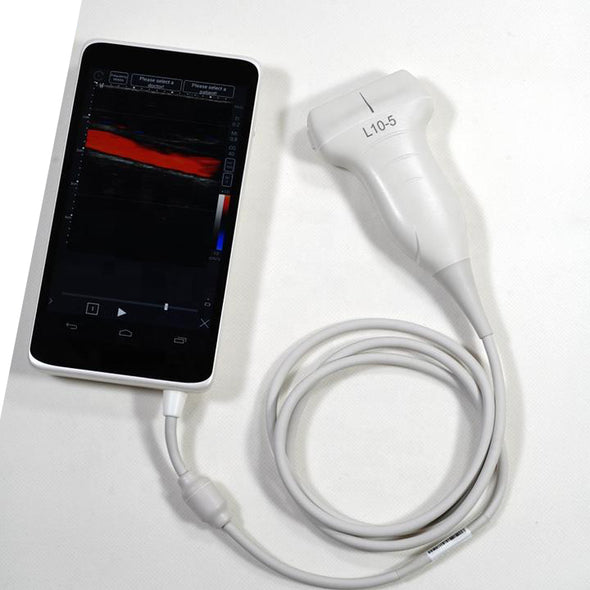 Color Doppler Linear array probe with Android Smart Phone