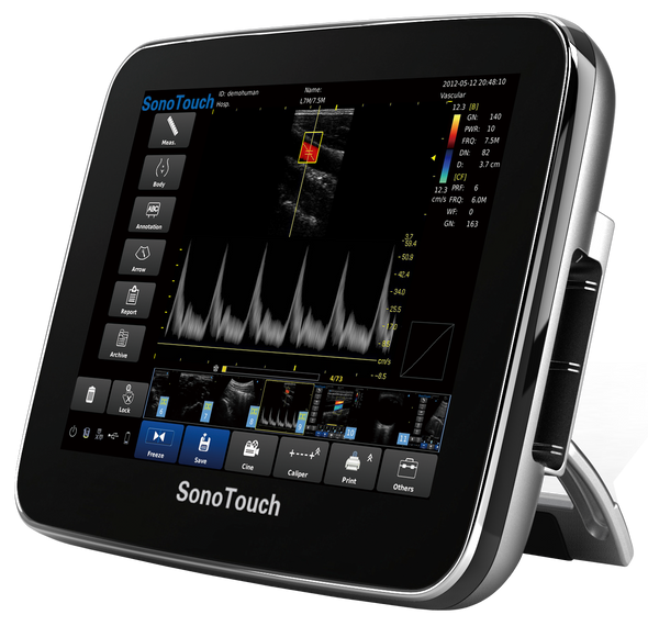 Chison SonoTouch 30Vet Animal Ultrasound