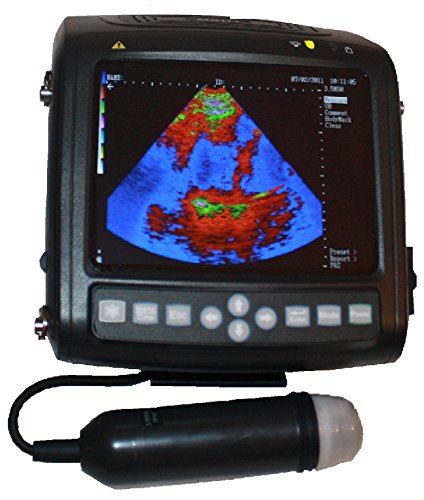 Full Digital Mechanical Sector Ultrasonic Diagnostic Instrument(veterinary) with