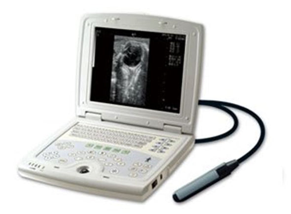 KX5000V Veterinary Laptop Ultrasound-Bovine/Horse & Rectal Insertion Arm-Keebome