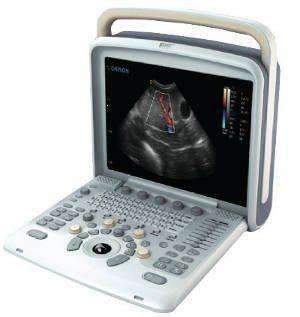 Chison Q5Vet On Sale,Color doppler,Chison,KeeboVet Veterinary Ultrasound Equipment.
