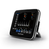 Chison Sonotouch 30Vet,Color doppler,Chison,KeeboVet Veterinary Ultrasound Equipment.