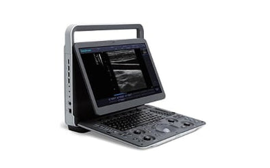 SonoScape E1V Ultrasound Machine | KeeboVet