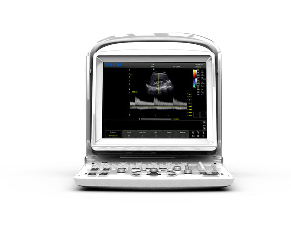 Chison ECO3Vet Animal Ultrasound | Quality Imaging | KeeboVet