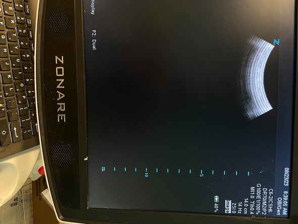 ZONARE C6-2 Ultrasound Probe Transducer