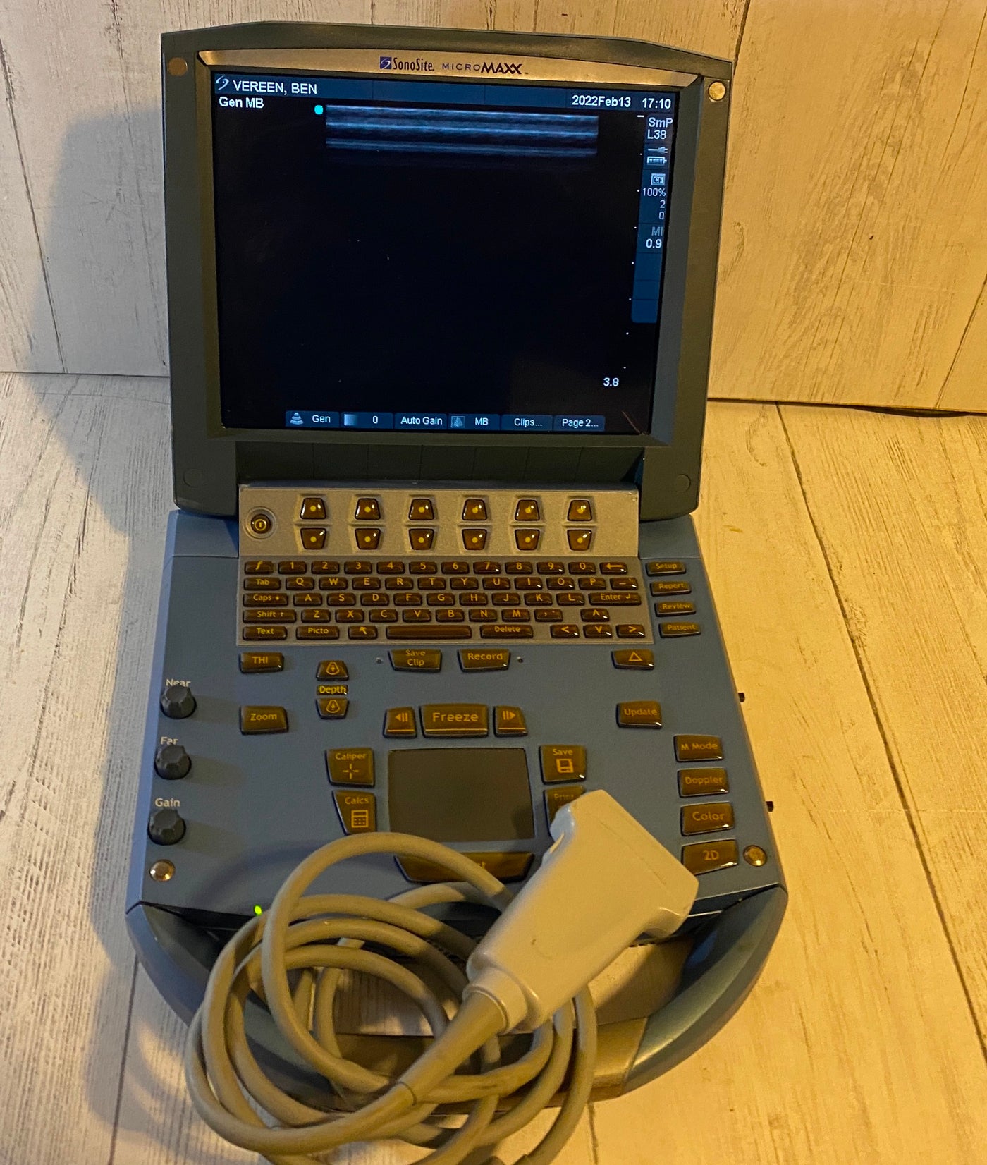 Micromaxx Sonosite MicroMaxx Portable Ultrasound 2008 - Main unit – KeeboVet ...