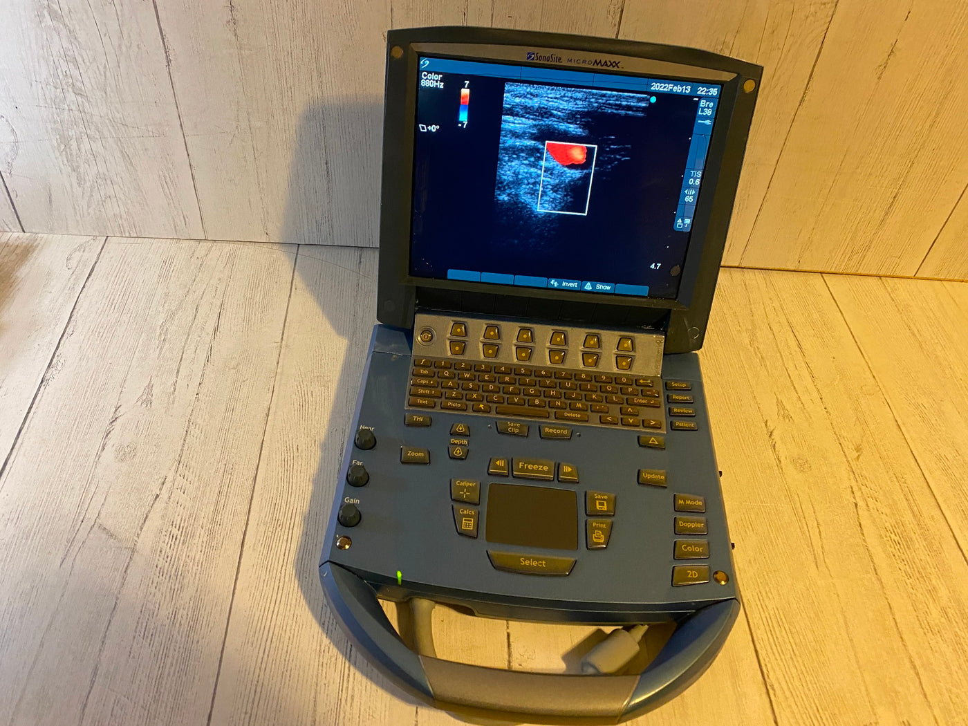 Micromaxx Sonosite MicroMaxx Portable Ultrasound 2007- Main unit – KeeboVet ...